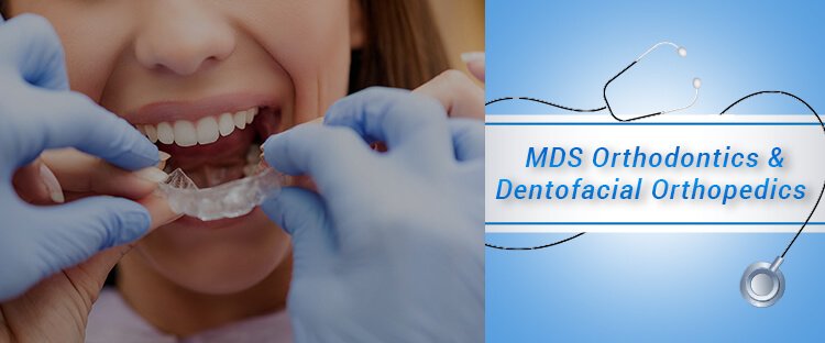 9372261584@MDS Orthodontics And Dentofacial Orthopaedics : Direct Admissions, Dental Colleges, Eligibility Criteria, Syllabus, Fees Structure Details